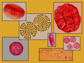
Chaîne d'observations microscopiques : un outil pour la recherche. Images numériques. Palynologie. 1 - *Àcacia farnesiana 60 m m. 2 - Echinops sp (chardon bleu) 65 m m Paléolithique moyen – Um el Tlell (Syrie). 3 - Ocimum basilicum (basilic) 60 m m. 4 - Dianthus gratianopolitanus (œillet) 40 m m. 5 - Turgenia sp 60 m m Paléolithique moyen – Um el Tlell (Syrie). 6 - Diatomée 60 m m Niveaux pléniglaciaires Kirkgöz (Sud-Ouest de l'Anatolie ). 7 - Fraxinus excelsior (frêne) 25 m m. Microscope à lumière transmise.  Collection de référence du Laboratoire de Palynologie- UMR 7041 - Equipe Ethnologie Préhistorique  Grains de pollen ou algue fossiles

