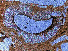 
Chaîne d'observations microscopiques : un outil pour la recherche. Images numériques. Palynologie
