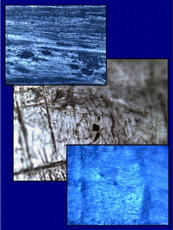 
Chaîne d'observations microscopiques : un outil pour la recherche. Images numériques. Tracéologie osseuse. À gauche : traces de préhension sur la partie centrale d'une pointe expérimentale. Microscope à lumière réfléchie (x100). Au centre : ostéone (dépression circulaire naturelle de la surface, entourée de cercles concentriques) (x200). Microscope à lumière réfléchie. À droite : surface osseuse naturelle avec ostéones (x200). Microscope à lumière réfléchie
